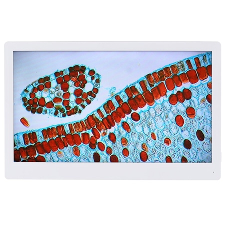 Amscope 1080p HDMI Monitor with Mounting Bracket for HD1080 and HD1080A Cameras HDM