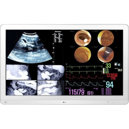 Lg 32INCH MEDICAL IPS 4K SURGICAL MONITOR, 3480X2160, HDMI DP USB, HDR10 DICOM H 32HL714S-W