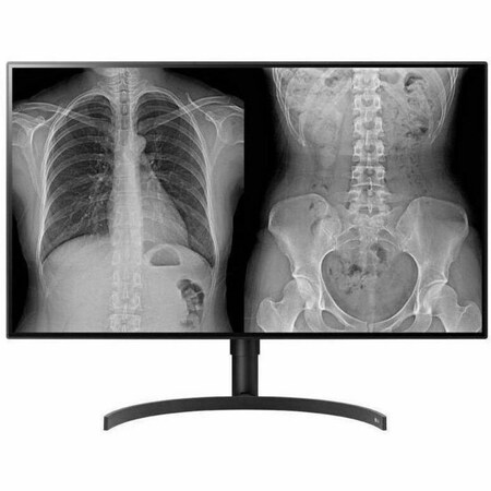 Lg 32HL512D-B 32" Class 4K UHD LCD Monitor - 16:9 - Black - TAA Compliant 32HL512D-B