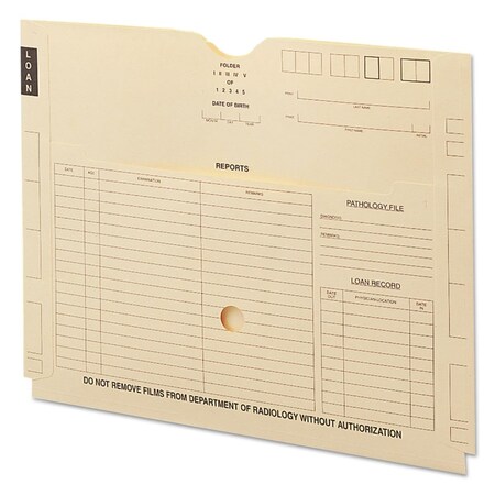 Smead Straight Tab X Ray Jacket with Pocket, 100PK SMD66300