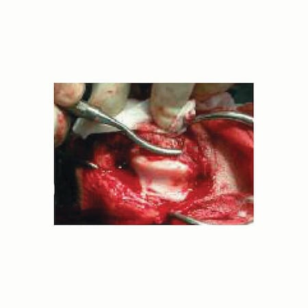 Jorgensen Laboratories Osteophyte Rasp J0209R