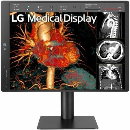 Lg 21 LG MEDICAL IPS 3MP DIAGNOSTIC MONITOR, 2048 X 1536, DVI, USB, DP, DICOM14, CA 21HQ513D-B