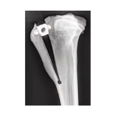 Jorgensen Laboratories 7.5mm x 19mm TTA Cage Titanium Screw, 2.4mm J1072LCT