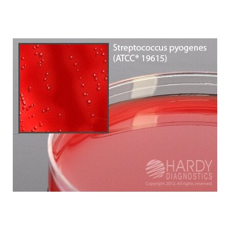 Hardy Diagnostics Selective Beta Strep Agar For Group A S A72