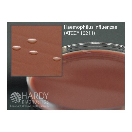 Hardy Diagnostics Mueller Hinton Agar With Chocolate 15X1 E20