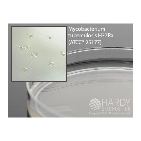Hardy Diagnostics Middlebrook 7H11 Thin Pour 10X100mm Spa SP57