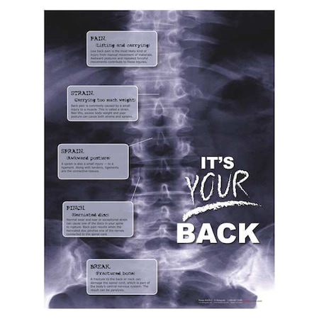 Safetyposter.Com Safety Poster, X-Ray Its Your Back, 22 in H x, 17 in W, Paper P4450