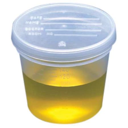 Globe Scientific Specimen Container, 5 oz., PK300 5917