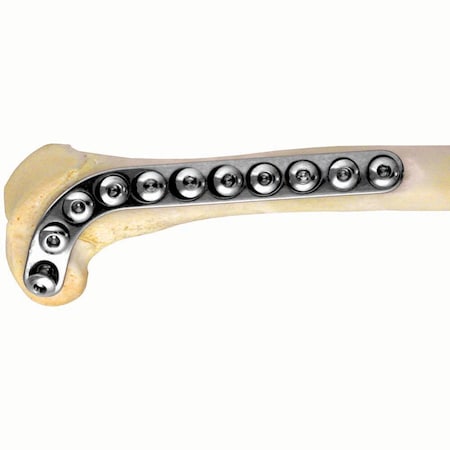 Jorgensen Laboratories Distal Femur Plate, 50mm, Left, 2mm Holes J0428P