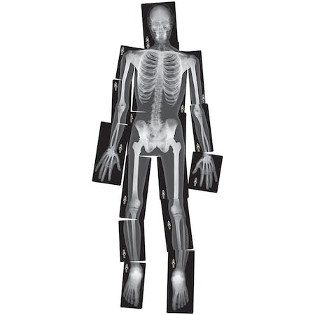 Roylco True to Life Human X-Ray Set, 18 Pieces R5911