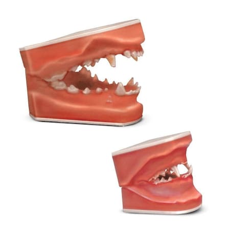 Jorgensen Laboratories Pathology Dental Models, Set of Both Models, 2PK J0771S