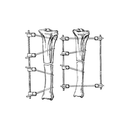 Jorgensen Laboratories Medium Fixation Type II Kit, Medium IM P", 1/8"x9" Rod, 8"L, 14PK J0371KBM
