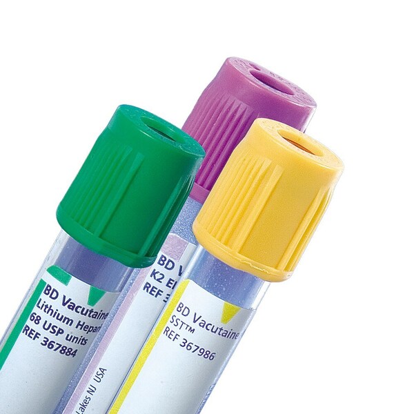 Bd Vacutainer SST Venous BC Tube, Clot Activator/Separator Gel Additive, 10mL, Conventional Tube, 100PK 367985 - main