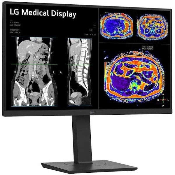 Lg 27 8MP CLINICAL MONITOR BLACK 27HS713C-B - main