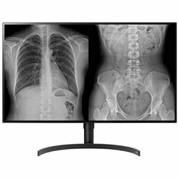 Lg 32HL512D-B 32" Class 4K UHD LCD Monitor - 16:9 - Black - TAA Compliant 32HL512D-B - main