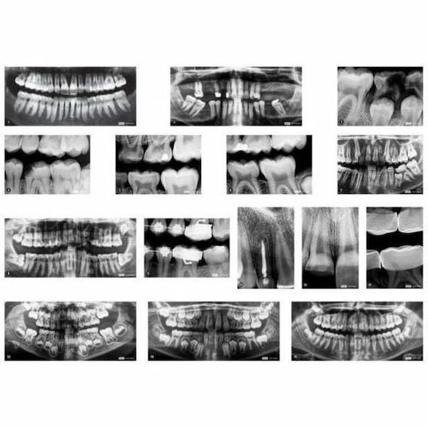 Roylco Dental X-Rays R59269 - main