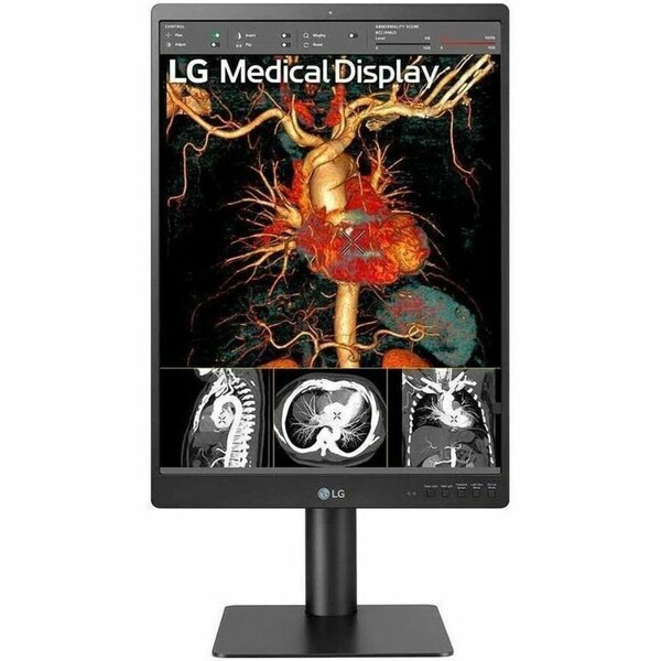 Lg 21 3MP DIAGNOSTIC MONITOR 21HQ513D-S - main