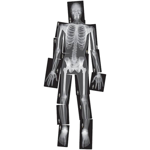 Roylco True to Life Human X-Ray Set, 18 Pieces R5911 - main