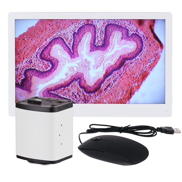 Amscope 1080p 15fps 5MP HDMI Color CMOS C-mount Microscope Camera with Monitor HD1080A-HDM - main