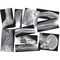 Roylco Broken Bones X-Ray Set, 15 Pieces R5914 - alternate 1