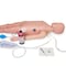 Ilc AED Replacement Medical Equipment LF03616 - alternate 2