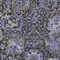 Homeroots 8' X 10' Purple And Black Damask Washable Indoor Outdoor Area Rug 609103 - alternate 4