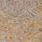 Homeroots 8' Gold And Peach Round Medallion Washable Indoor Outdoor Area Rug 616270 - alternate 7