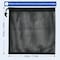 Simple Deluxe 17x17in Barrier Netting, Black Media Bag with Drawstring for Most Pumps, Pond Biological Filters LGPUMPFILTBAG17 - alternate 5
