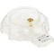 Danco Temperature Control Single Clear Tub & Shower Handle Kit 88202 - alternate 1