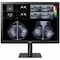 Lg 31IN LG MEDICAL ANTI-GLARE, 3H DIGNOSTIC MONITOR 4200 X 2800 3:2 CLASS II FDA 31HN713D-B - alternate 1